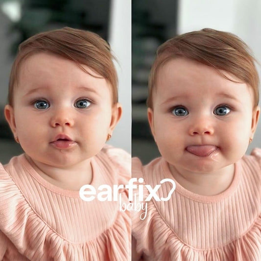 EarFix – Ngjitëse Korrigjuese për Veshët e Bebes, 6 Copë – Hipoalergjike dhe Rezistente ndaj Ujit (3+ Muaj)