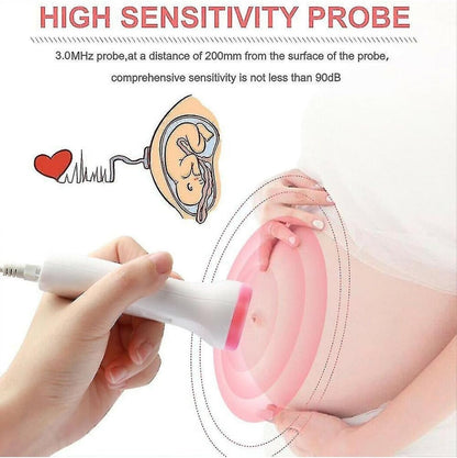 Aparat për Dëgjimin e Rrahjeve të Zemrës së Bebes – Doppler Fetal