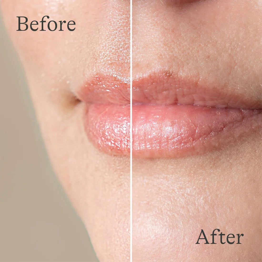 Lansinoh Lanolin Lip Balm – 2 Copë – imazhi 5