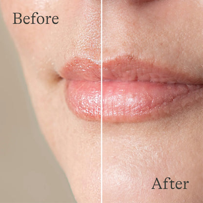 Lansinoh Lanolin Lip Balm – 2 Copë – imazhi 5